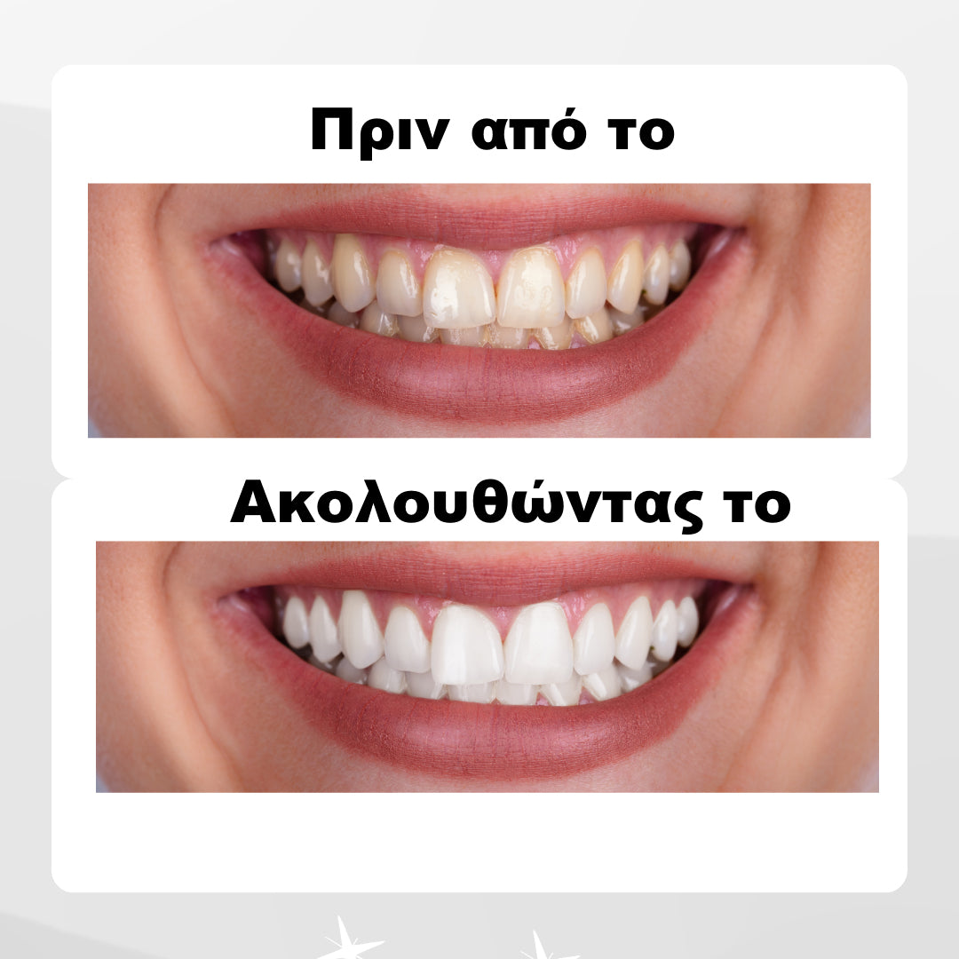 WhiteMe - λευκαντικές ταινίες PAP+